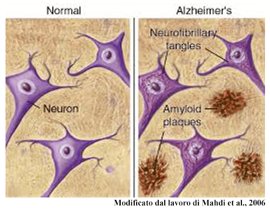 Da dove origina l'Alzheimer?